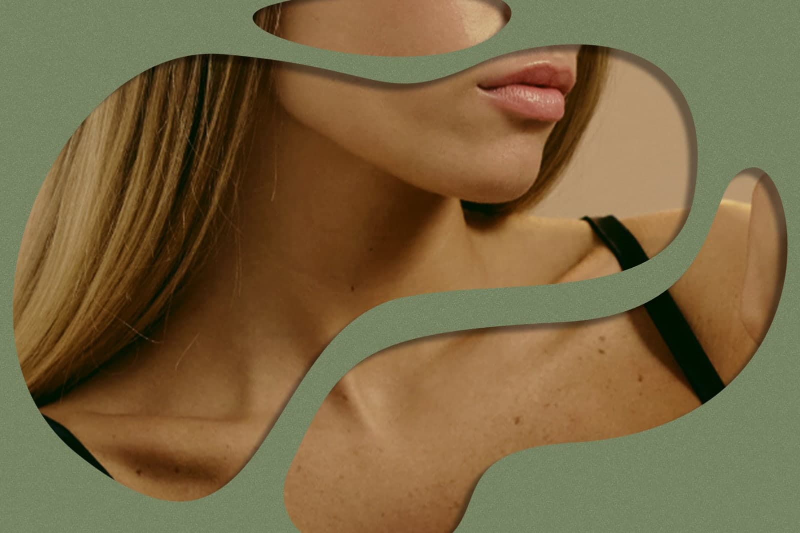 Clogged pores image