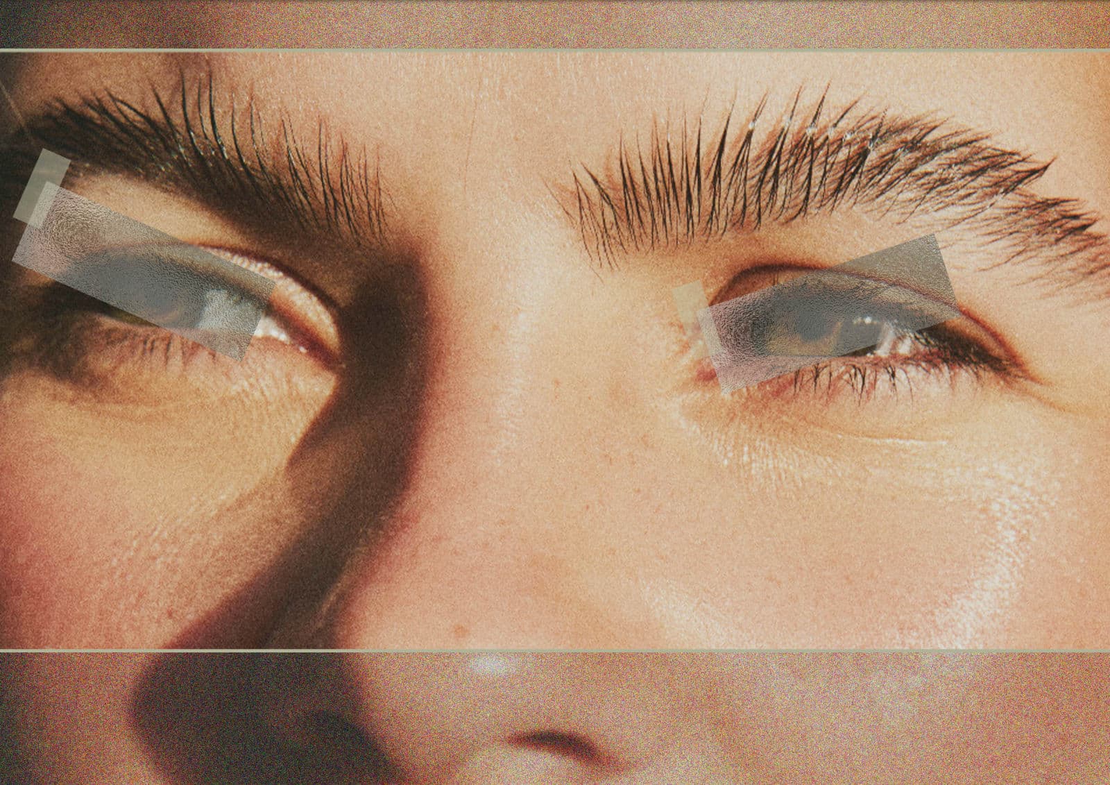 Blind pimple image