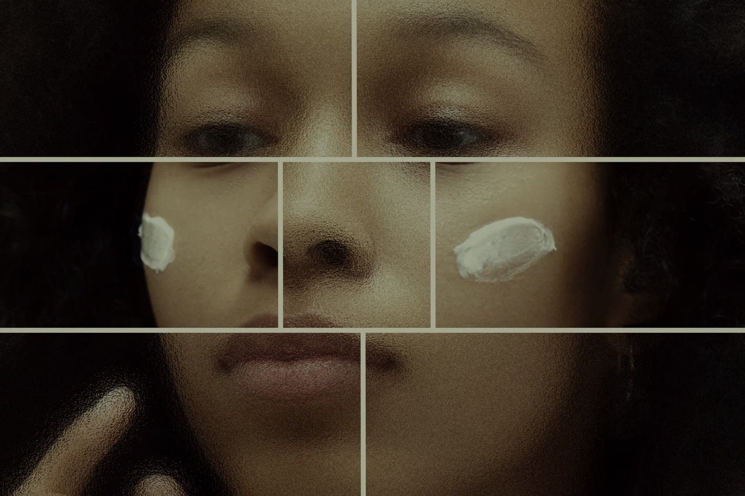Breakout after moisturizer image